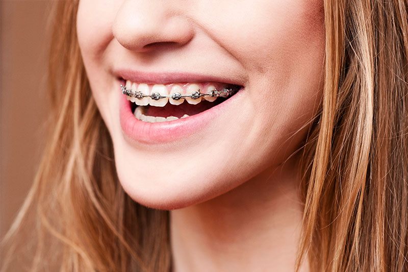 Orthodontics in Brentwood